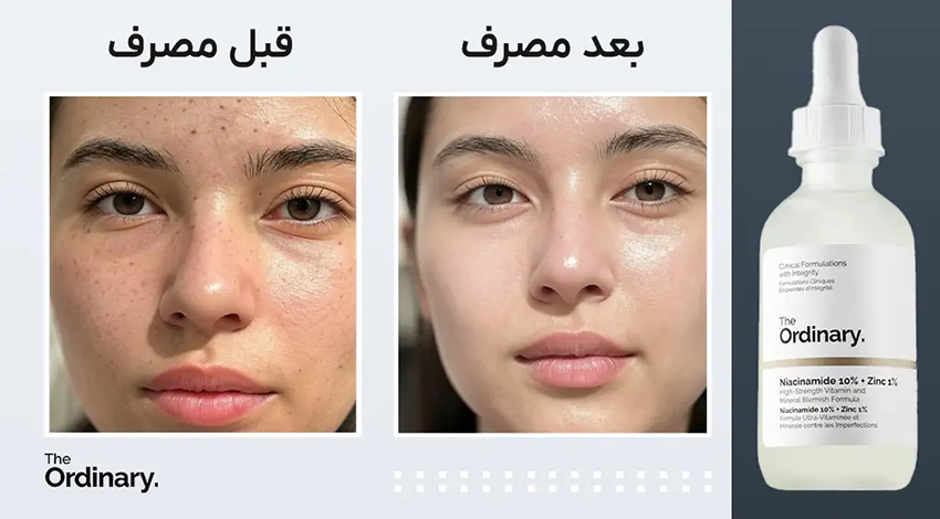 سرم نیاسینامید اوردینری