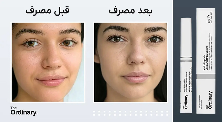 سرم تقویت مژه اوردینری
