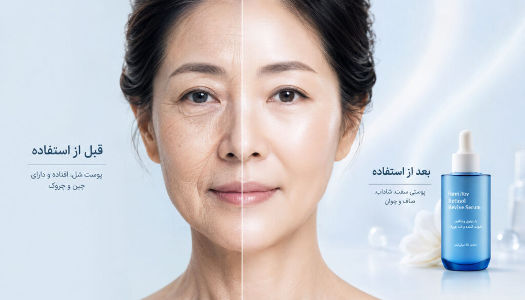اثربخشی رتینول فارم استی